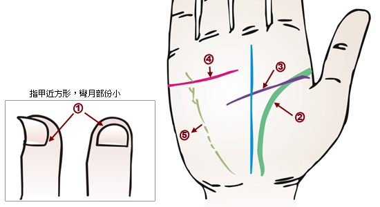 掌紋分析：十二指腸潰瘍掌徵